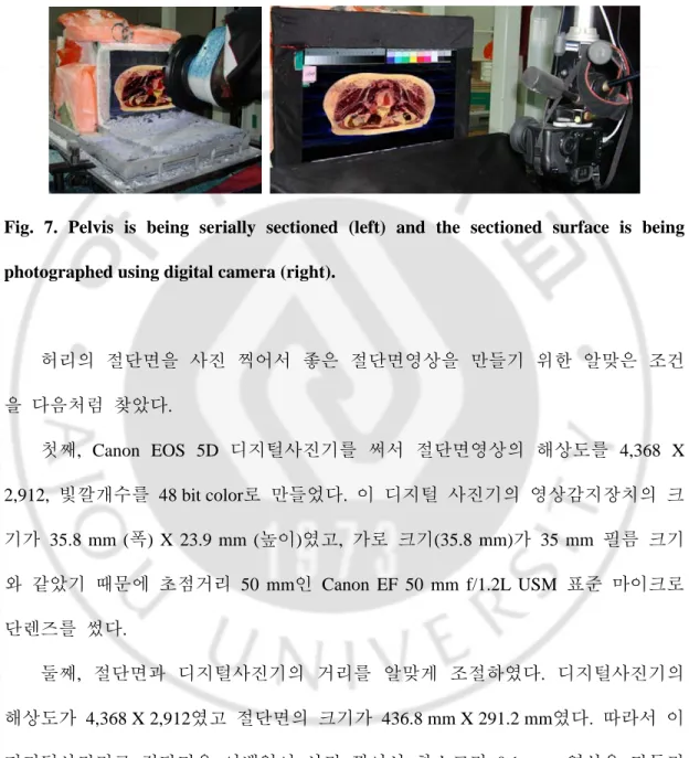 Fig. 7. Pelvis is being serially sectioned (left) and the sectioned surface is being  photographed using digital camera (right)