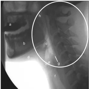 Fig.  3.  This  figure  shows  normal  lateral  image  from  a  VFSS.  The  components  of  normal  structure  are  as  followings