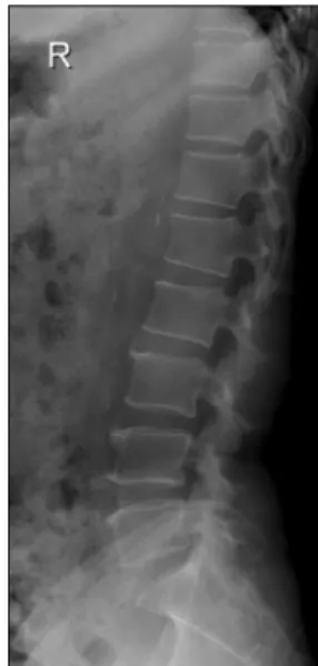 Fig. 1. Brain CT (2012.06.12).