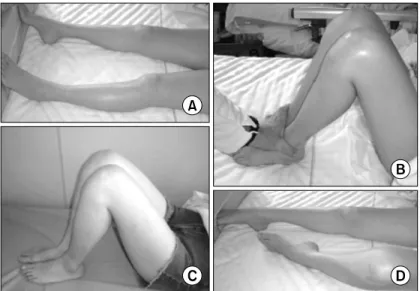 Fig. 5. Spinal injuries center test 10) . 두 마비된 다리가 마비되지 않은 다리에 비해 적게 외전되 는  것을  관찰할  수  있다