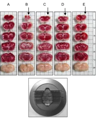Fig. 2. Representative TTC-stained brain sections taken from sham-op- sham-op-erated, tMCAO rats at 10 days postsurgery