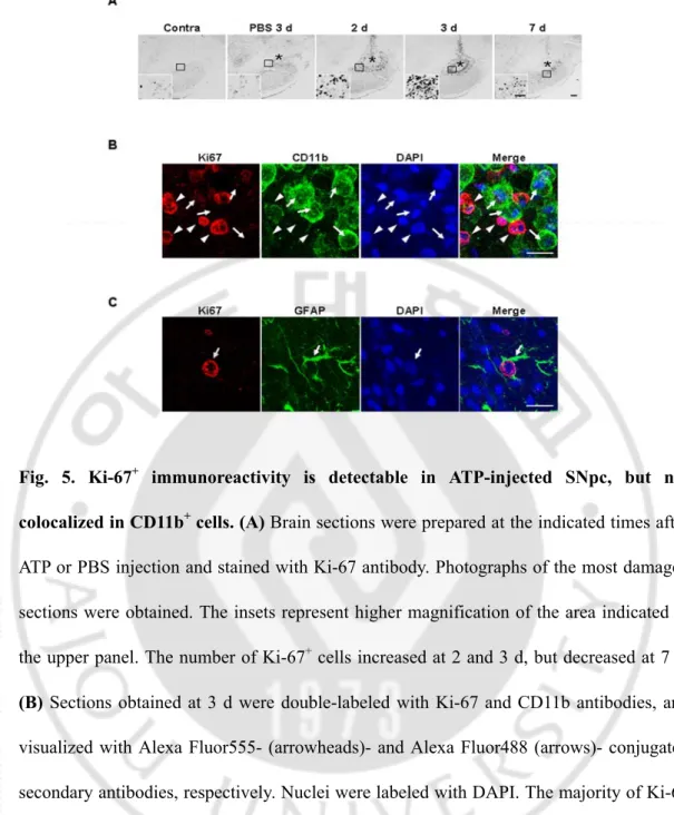 Fig. 5. Ki-67 +  immunoreactivity is detectable in ATP-injected SNpc, but not 
