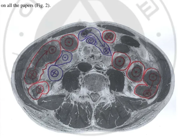 Fig. 2. Gastrointestinal tract on paper, which is denoted with direction signs. 