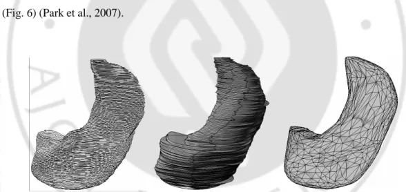 Fig.  6.  Stacked  outlines  of  stomach  (left),  surface  model  with  the  stacked  outlines  preserved (center), and surface model with the stacked outlines deleted (right)