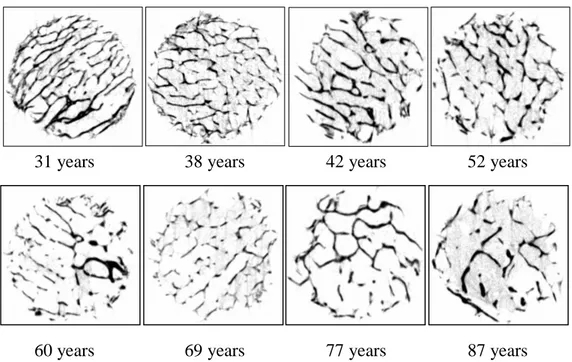 Fig.  4.  2D  tomographic  images  extracted  from  consecutive  microtomographic  slices of micro-CT in the same location of samples