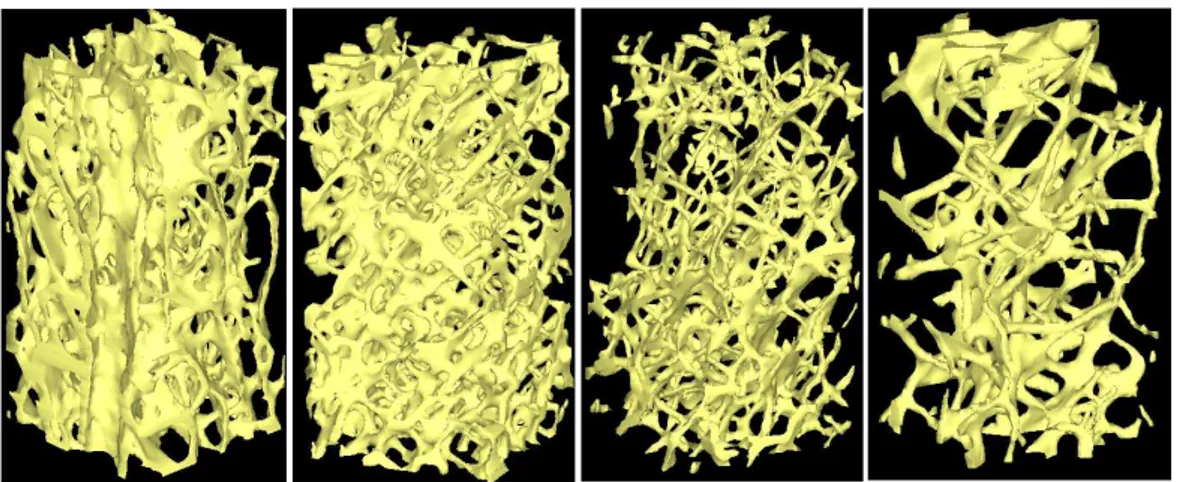 Fig.  5.  3D  micro-CT  reconstruction  images  of  four  samples  with  aging  from  human cancellous bone of intertrochanteric area