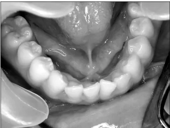 Fig.  1.  Illustration  of  oral  cavity.