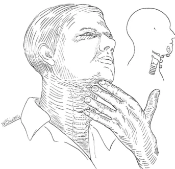 Fig.  1.  The  correct  positioning  of  the  fingers  during  the  clin- clin-ical  or  bedside  swallowing  examination.