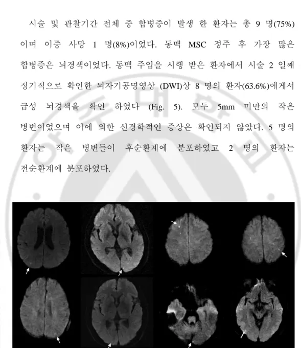 Fig. 5. The acute infarct lesions on brain MRI (DWI) after intra-arterial injection.   