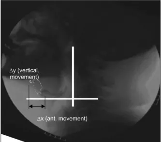 Fig.  2.  Quantitative  measurement  of  hyoid  bone  movement.