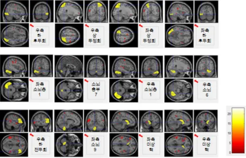 [그림  2]  도형  과제  수행  때  활성화된  12개  뇌  영역의  영상과  활성  부위(화살표)3.  fMRI  영상 획득과 처리