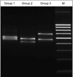 Fig.  1.  Products  of  multiplex  PCR  for  HLA  gene  targeted.  Group  1  is  the  PCR  products  of  HLA-A  exon  4,  HLA-B  exon  2  and  4