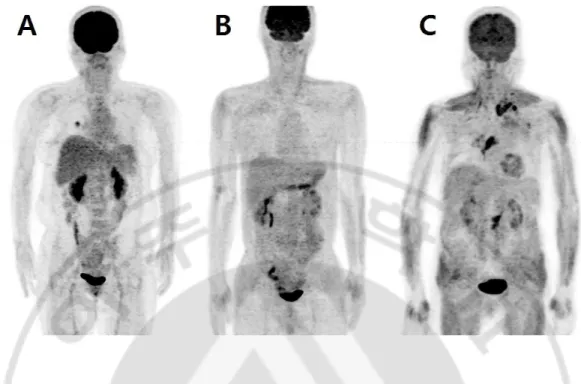 Fig.  1.  Example  of  F-18  FDG  PET  maximum-intensity-projection  image  quality  using  visual  grading