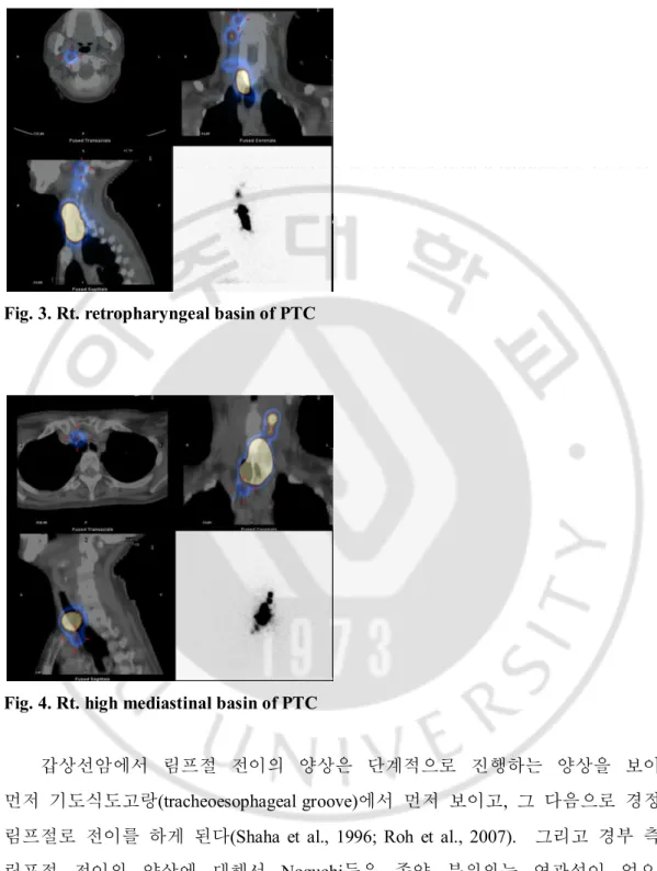 Fig. 3. Rt. retropharyngeal basin of PTC 