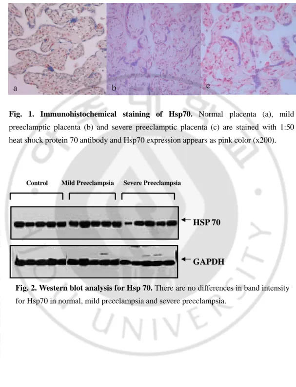 Fig. 2. Western blot analysis for Hsp 70. There are no differences in band intensity 