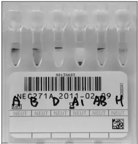 Fig.  3.  Reactions  by  (A)  Kpn  I  restriction  enzyme  and  (B)  Alu  I  restriction  enzyme