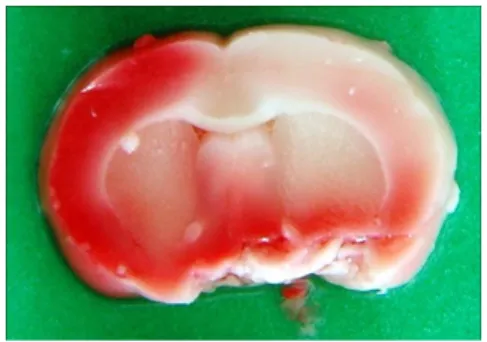 Figure 1.  Histological  change  of  cerebrum  of  preischemic  brain  (TTC  stain  ×  100).