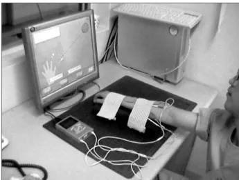 Figure 1. Diagram of functional electric stimulation-assisted bio- bio-feedback therapy system.