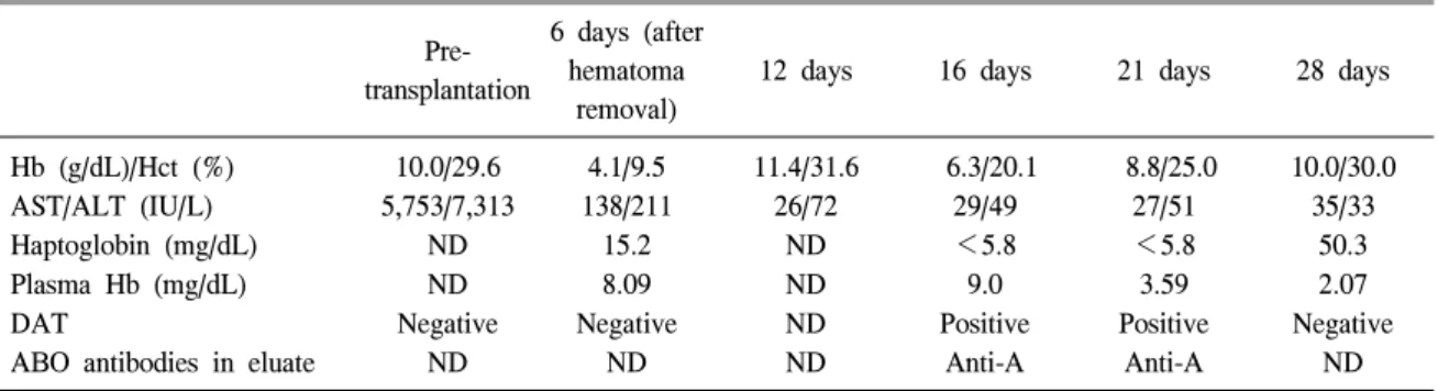 Table  2.  Change  in  the  laboratory  values  during  the  period  of  immune  hemolysis  after  transplantation Pre-  transplantation 6  days  (after hematoma  removal)