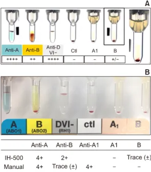 Fig.  1.  Serologic results of ABO typing (A) by IH-500, and (B) by manual microcolumn agglutination tests.