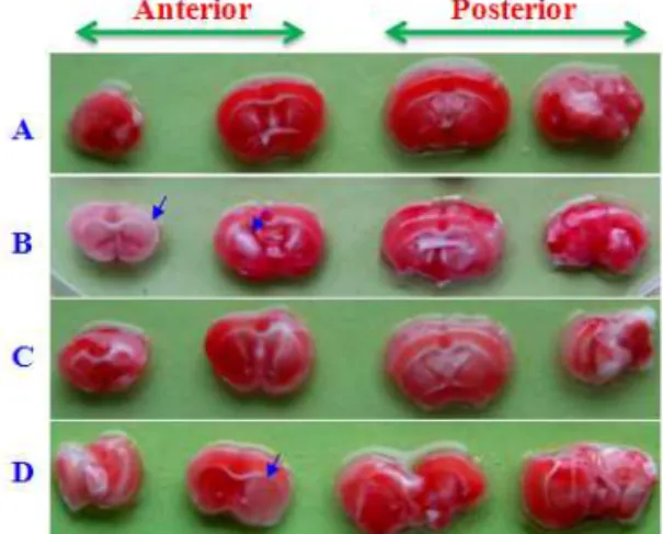 Fig. 7. Effects of HBSBS on the coronal section of bA-induced Alzheimer's mice.