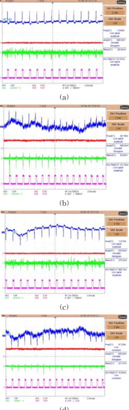 Fig. 13. Measured  Waveforms  of  Fabricated  ECG  detector  그림 13. 제작된  심전도  검출기의  실험  결과  파형     그림  13  (a)는  높은  SNR의  환경에서  일반적인  심전도  입력인  경우,  그림  13  (b)는  낮은  SNR의  환경에서  DC-오프셋을  갖는  심전도  입력인  경우,  그림  13 (c)는  높은  SNR의  환경에서  반전된  심전도  입력인 경우,  