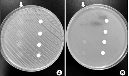 Fig.  1.  The  agar  plates  coated  with  Staphylococcus  aureus  (A)  and  Pseudomonas  aeruginosa  (B)  from  a  donor