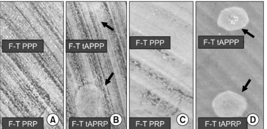 Fig.  2.  The  imprints  of  direct  droppings  of  F-T  PPP,  F-T  PRP,  F-T  tAPPP  and  F-T  tAPRP  on  agar  plates  coated  with  Staphylococcus  aureus  (A,  B)  and  Pseudomonas  aeruginosa  (C,  D)