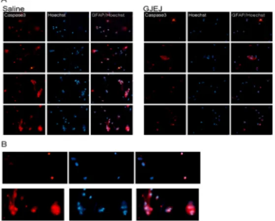 Fig.  4.  Comparison  of  caspase  3-positive  glial  cell  counts  among  groups  given  different  treatments