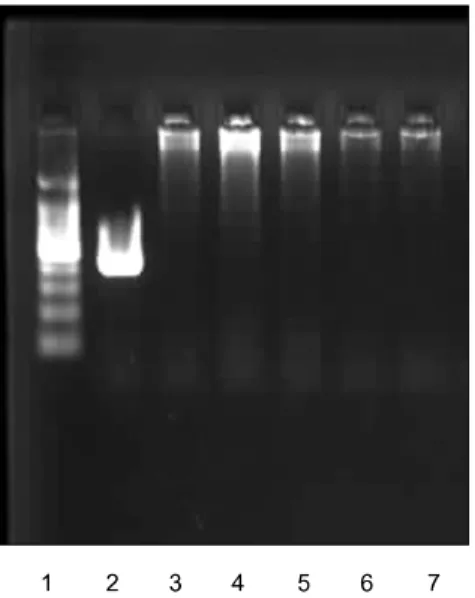 Fig.  1. Electrophoretic  analysis  by  PCR  to  detect  Ureaplasma.  Lane  1,  100  bp  DNA  marker;  Lane  2,  positive  control;  Lane  3,  negative  control;  Lane  4∼