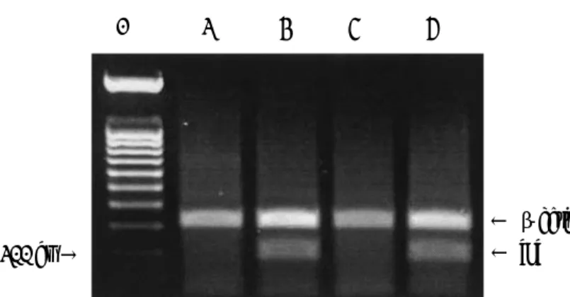 Fig. 5. RT-PCR  analysis  of  HIV-1  tat gene  expression  in  HeLa-LT2  and  CCRF-CEM-LT1  cells.  HIV-1  tat mRNA extracted from HeLa-LT2 and CCRF-CEM-LT1 cells was detected by RT-PCR amplification of 200  bp  cDNA  fragments.  mRNA  from  HeLa  and  CCR