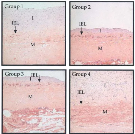 Fig. 4. Light microscopic appearance of vascular anastomotic vein site. Marked suppression of the intimal hyperplasia was  showed  in  E2F  decoy-treated  group  compared  with  heparin-treated  group  or  mismatched oligodeoxynucleotides (ODN)-treated gro