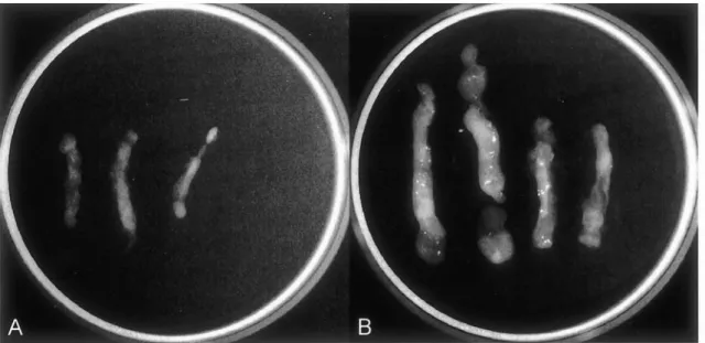 Fig. 2. Magnification X-ray radiograph of biopsed specimen. Note much large size of the specimen materials and more number of calcifications in the case of 8-gauge Mammotome probe (B) than in the case of 11-gauge probe (A).