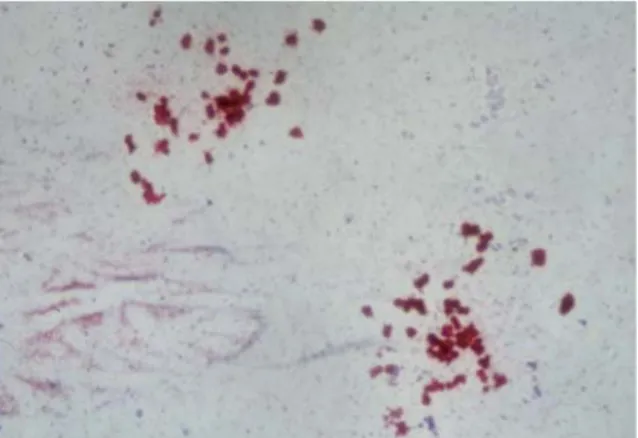 Fig. 2. Microphotograph  of  mixed  CFU-MK  (Evans blue stain, x 40).