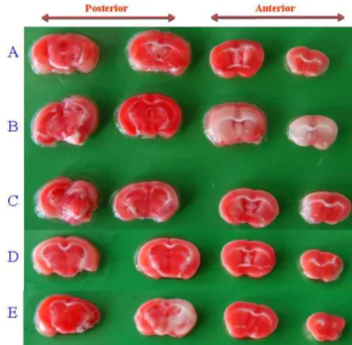 Fig. 6. Effects of KBHT hot water extract and KBHT ultra-fine powder on the infarct size of β A-induced Alzheimer's mice brain.