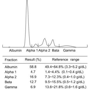 Table  1.   Lymphocyte  subset  results Test Absolute counts  (/µl) Events (%) Specificity CD3 3,615 95 T  cell CD4 1,119 29 Helper/Inducer  T CD8 2,378 62 Suppressor/Cytotoxic  T CD19 7 0 B  cell