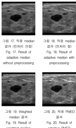Fig.  15.  Result  of  thinning        