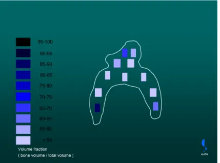 Fig. 11. Volume fraction of stapes in congenital stapedial fixation. Left side  shows  the  reference  to  scale  color
