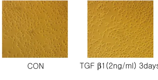 Fig. 5.    TGF  ββββ 1 doesn’t induce senescent phenotypes in R1B cells    R1B cells were 