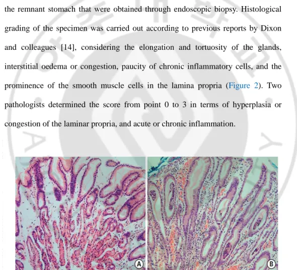 Fig.  2  Histological  findings  of  biopsied  tissues  in  the  remnant  stomach.  (A)  The  tissue was given a score of 0 on evaluation, as per the grading system suggested by  Dixon et al