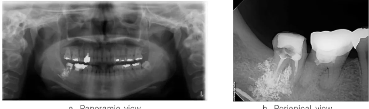 Fig. 1. The results of the radiographic examination at the first visit
