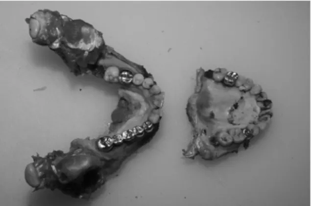 Fig.  8.  Dental  model  for  age  estimation