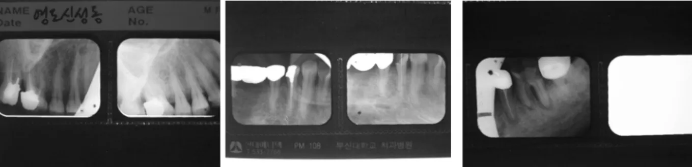 Fig.  12.  Visual  finding  of  victim