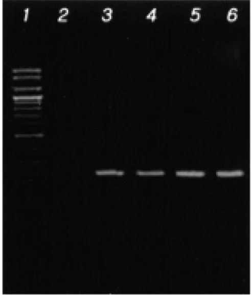 Fig.  2.  Amplified  products  of  mtDNA  hypervariable  control  regionⅠ(HV1)  on  2%  agarose  gel.