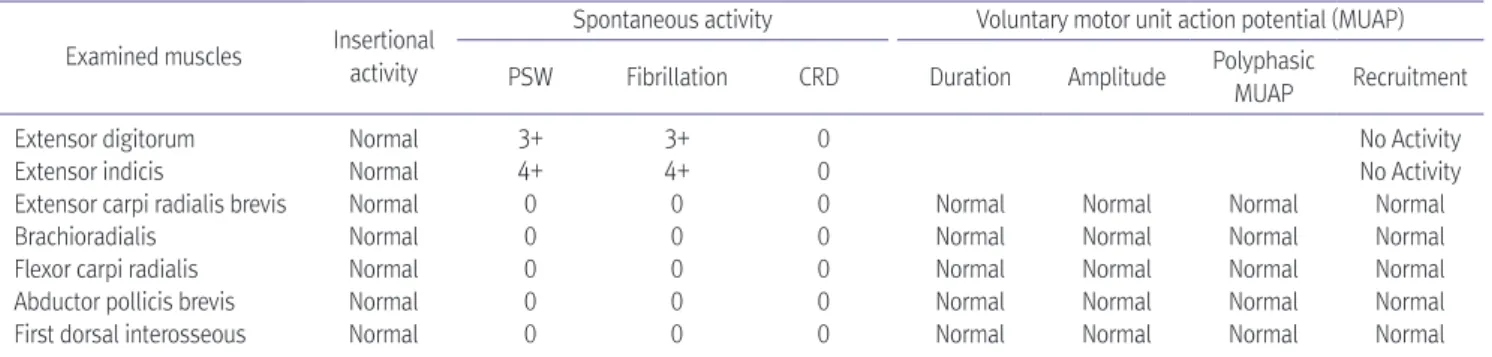 Table 2. Findings of Needle Electromyography of Left Upper Extremity Examined muscles Insertional  