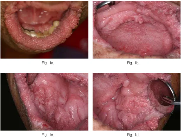 Fig.  1a.  Fig.  1b.