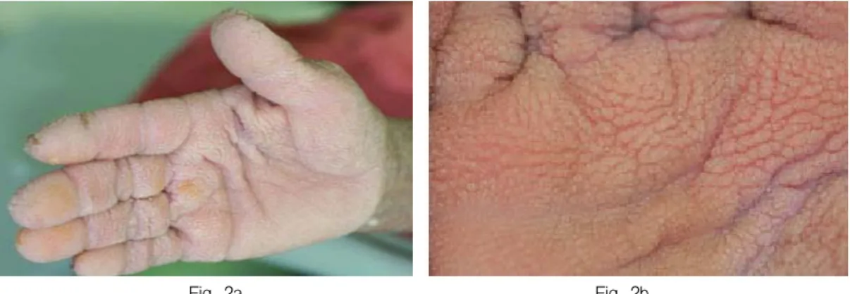 Fig.  2a.  Fig.  2b.