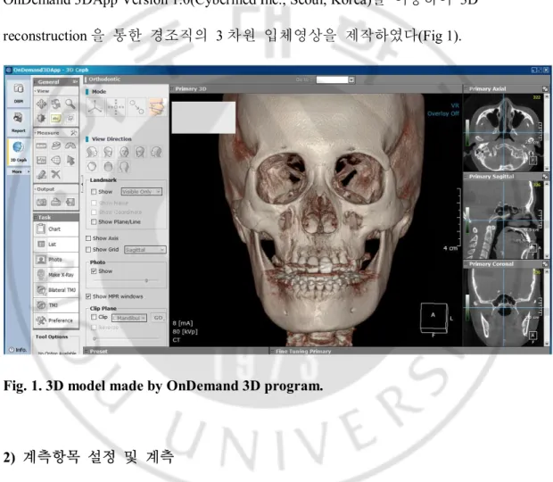 Fig. 1. 3D model made by OnDemand 3D program. 
