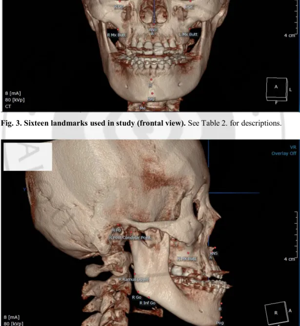 Fig. 4. Sixteen landmarks used in study (lateral view). 