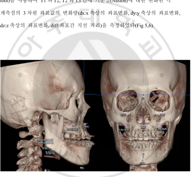 Fig. 5. 3D analysis using superimposition method. Red point: primary image; green point: 